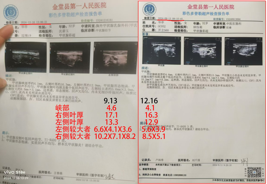 甲状腺结节-营养素干预疗法优享社区-健康管理-优享健康生活社区